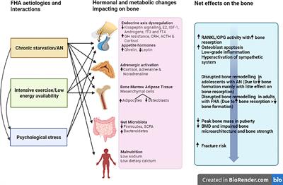 Bone Perspectives in Functional Hypothalamic Amenorrhoea: An Update and Future Avenues